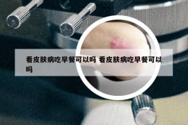 看皮肤病吃早餐可以吗 看皮肤病吃早餐可以吗