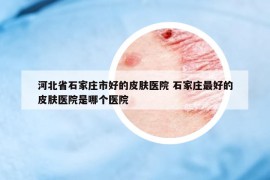 河北省石家庄市好的皮肤医院 石家庄最好的皮肤医院是哪个医院