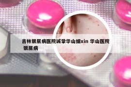 吉林银屑病医院诚挚华山细xin 华山医院 银屑病