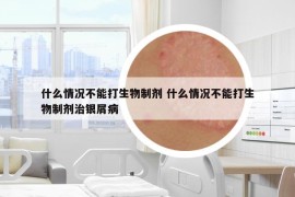 什么情况不能打生物制剂 什么情况不能打生物制剂治银屑病