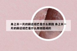 身上长一片的藓还结巴是什么原因 身上长一片的藓还结巴是什么原因造成的