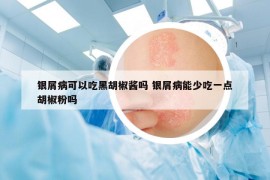 银屑病可以吃黑胡椒酱吗 银屑病能少吃一点胡椒粉吗