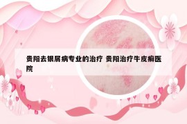 贵阳去银屑病专业的治疗 贵阳治疗牛皮癣医院