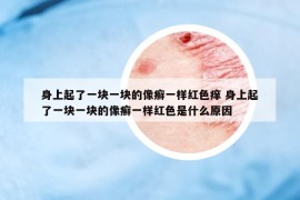 身上起了一块一块的像癣一样红色痒 身上起了一块一块的像癣一样红色是什么原因
