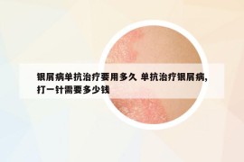 银屑病单抗治疗要用多久 单抗治疗银屑病,打一针需要多少钱
