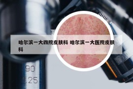 哈尔滨一大四院皮肤科 哈尔滨一大医院皮肤科
