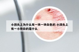 小孩头上为什么有一块一块白色的 小孩头上有一小块白的是什么