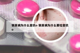银屑病为什么查抗o 银屑病为什么要检查抗o