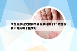 成都皮肤研究院和华西皮肤科哪个好 成都皮肤研究所哪个医生好