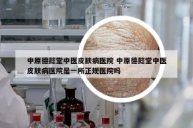 中原德懿堂中医皮肤病医院 中原德懿堂中医皮肤病医院是一所正规医院吗