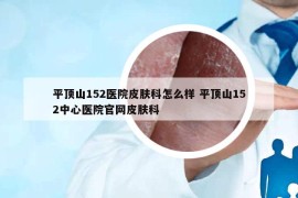 平顶山152医院皮肤科怎么样 平顶山152中心医院官网皮肤科