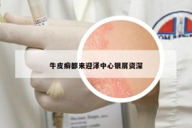 牛皮癣都来迎泽中心银屑资深