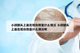 小孩额头上面出现白斑是什么情况 小孩额头上面出现白斑是什么情况呢