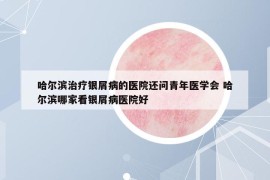哈尔滨治疗银屑病的医院还问青年医学会 哈尔滨哪家看银屑病医院好