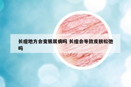 长痘地方会变银屑病吗 长痘会导致皮肤松弛吗