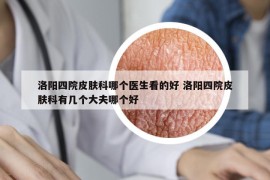 洛阳四院皮肤科哪个医生看的好 洛阳四院皮肤科有几个大夫哪个好