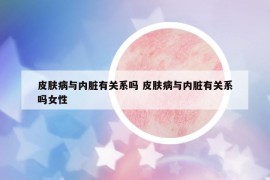皮肤病与内脏有关系吗 皮肤病与内脏有关系吗女性