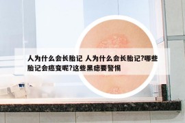 人为什么会长胎记 人为什么会长胎记?哪些胎记会癌变呢?这些黑痣要警惕