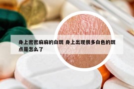 身上密密麻麻的白斑 身上出现很多白色的斑点是怎么了