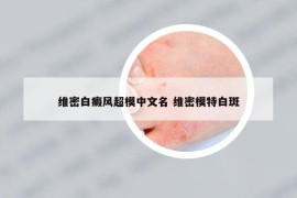 维密白癜风超模中文名 维密模特白斑