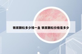 银屑颗粒多少钱一盒 银屑颗粒价格是多少