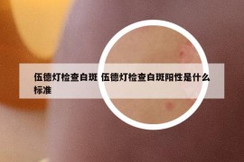 伍德灯检查白斑 伍德灯检查白斑阳性是什么标准