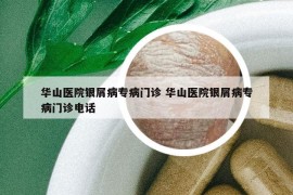 华山医院银屑病专病门诊 华山医院银屑病专病门诊电话