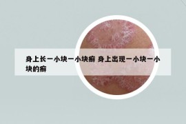 身上长一小块一小块癣 身上出现一小块一小块的癣