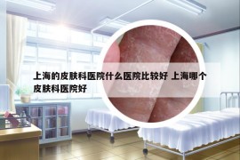 上海的皮肤科医院什么医院比较好 上海哪个皮肤科医院好