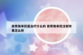 依奇珠单抗是治疗什么的 依奇珠单抗注射效果怎么样