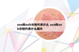 uva和uvb分别代表什么 uva和uvb分别代表什么图片