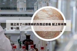 腿上长了一块像癣的东西还很痛 腿上有块像癣一样