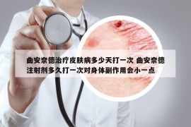 曲安奈德治疗皮肤病多少天打一次 曲安奈德注射剂多久打一次对身体副作用会小一点