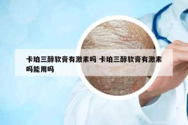 卡珀三醇软膏有激素吗 卡珀三醇软膏有激素吗能用吗