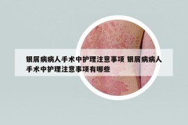 银屑病病人手术中护理注意事项 银屑病病人手术中护理注意事项有哪些