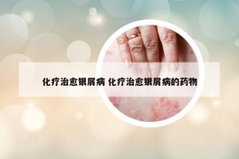 化疗治愈银屑病 化疗治愈银屑病的药物