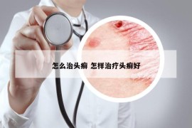 怎么治头癣 怎样治疗头癣好