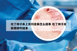 吃了柿子身上有刘皮癣怎么回事 吃了柿子皮肤瘙痒咋回事