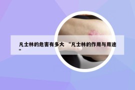 凡士林的危害有多大 “凡士林的作用与用途”