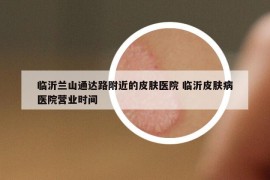 临沂兰山通达路附近的皮肤医院 临沂皮肤病医院营业时间