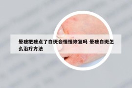 晕痣把痣点了白斑会慢慢恢复吗 晕痣白斑怎么治疗方法