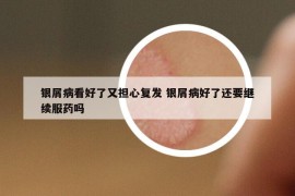 银屑病看好了又担心复发 银屑病好了还要继续服药吗