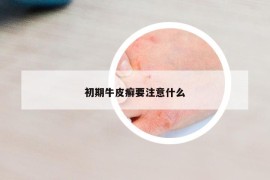 初期牛皮癣要注意什么