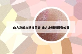 曲方净颜皮肤抑菌膏 曲方净颜抑菌膏效果