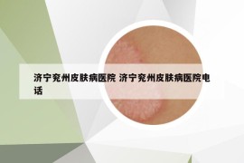 济宁兖州皮肤病医院 济宁兖州皮肤病医院电话