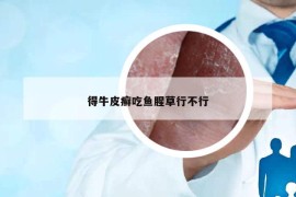 得牛皮癣吃鱼腥草行不行