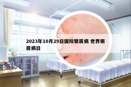 2023年10月29日国际银屑病 世界银屑病日