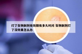 打了生物制剂有效期有多久时问 生物制剂打了没效果怎么办