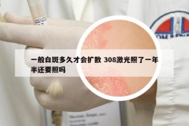 一般白斑多久才会扩散 308激光照了一年半还要照吗