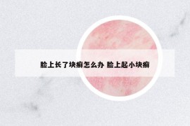 脸上长了块癣怎么办 脸上起小块癣